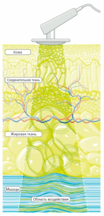 СИСТЕМА ХИВАМАТ